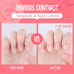 Chuchu nail growth support detail with before-and-after nails
