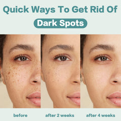 CITYGOO Dark Spot Remover texture-closeup shows quick-absorbing formula for non-sticky feel.