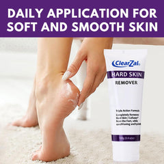 Clearzal foot cream targeting calluses and corns for relief