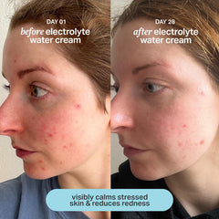 User applying Cocokind Electrolyte Water Cream for a light, non-greasy finish