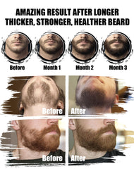 Beard grooming kit components laid out for easy routine