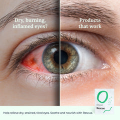 CorneaCare Rescue eye mask placed on eyes for quick cooling relief.