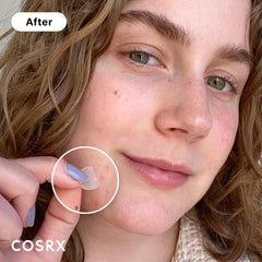 COSRX Acne Pimple Patch three-size set laid out for multiple blemishes