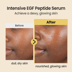 coxir Intensive EGF Peptides Serum pump-dispense, enabling quick, clean daily applications.