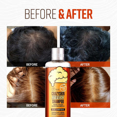 Crazy Skin German Beers Shampoo ingredients reveal beer yeast for biotin benefits