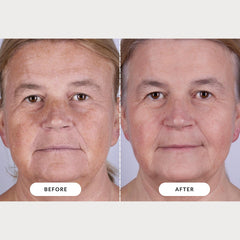 CurrentBody Skin LED Mask Series 2 NFC card reveals personalized results insights