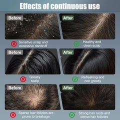 CWTUL Laser Hair Growth Comb rechargeable battery image emphasizes cordless convenience