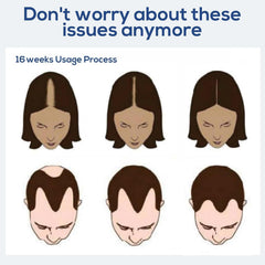 CWTUL Laser Therapy Hair Growth Comb side profile demonstrates ergonomic grip.