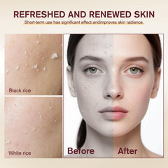 Dactylopius texture-swirl reveals dual rice enzyme exfoliation for smoother skin