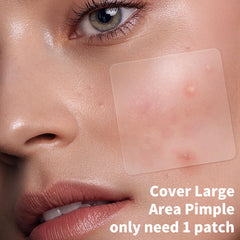 Daolyo strip 60x20mm patch covers larger chest or back breakout.