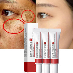 Dark Spot Face Cream tube closeup highlighting creamy texture for gentle application.