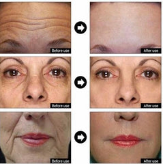 DERMA CLINICALS Vitamin C Hyaluronic Acid droplet delivers brightening hydration.