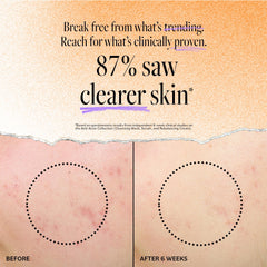Derma E Tea Tree and Lavender oils ingredient close-up for blemish care.