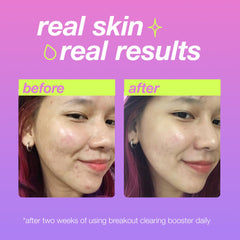 Dermalogica Clear Start booster serum drop close-up suggests precise spot treatment