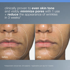 Dermalogica Liquid Peelfoliant pore-detox close-up shows oil control