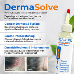 Dermasolve scalp oil dropper demonstrates precise application for targeted relief