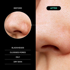 Dermasuri soft skin after use highlights smoother texture and skin prep readiness.