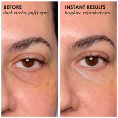 Dermelect Revitalite dark-circle-cream-tube brightens under-eye skin for a radiant look