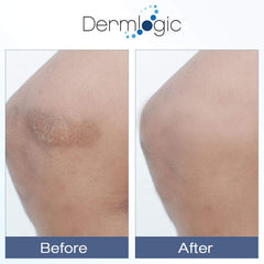 Dermlogic Vitamin K Cream under-eye shows potential to address dark circles.