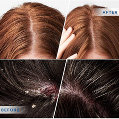 DERPHEA botanical extracts Sophora flavescens highlight soothing scalp support
