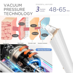 DIYthinker Blackhead Remover Vacuum USB recharge feature shown for cordless convenience.
