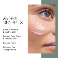 Doctor Rogers Restore Healing Balm on irritated skin provides moisture and a protective layer.