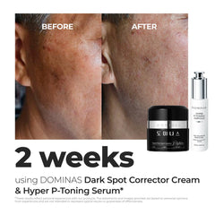 DOMINAS niacinamide and tranexamic acid ingredients graphic highlighting brightening benefits