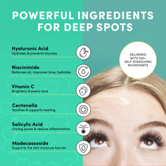 Dots for Spots niacinamide benefits closeup noting even skin tone support.