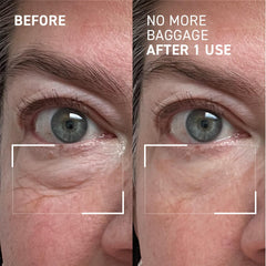 Dr. Brandt Needles No More fragrance-free formula on under-eye skin supports makeup wear.