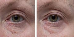 Dr. Denese SkinScience Hyaluronic Acid drops deliver lasting eye-area hydration.