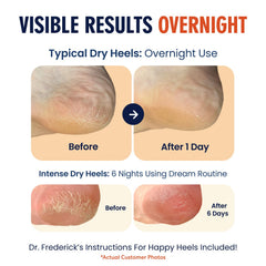 Dr. Frederick's Original heel socks on foot highlight breathable, comfortable wear.