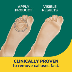 Dr. Scholl's hydrogel texture detail showing soft cushioning