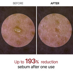 Dr.Melaxin Peel Shot Glow ampoule exfoliating texture on skin signaling gentle refinement.