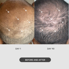 DS Laboratories StimuROLLER used on scalp with serums to improve absorption