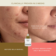 EADEM Milk Marvel ingredients graphic highlights Encapsulated Vitamin C and Niacinamide.