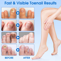Nails with EASICUTI patches showing easy no-mess application