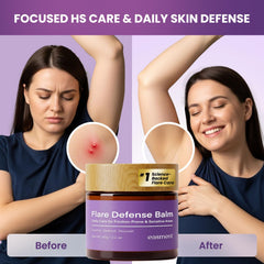 Easment Flare Defense Balm bottle highlights fast-absorbing, non-greasy formula.