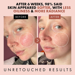 Eclat Skincare Rose Water Toner hyaluronic acid droplets illustrate deep hydration.