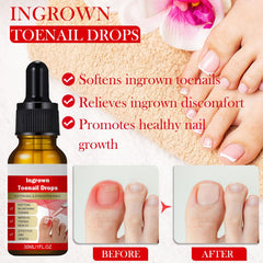 ELALRAU ingrown toenail corrector drops feature natural, gentle care for reshaping nails