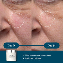 ELEMIS Dynamic Resurfacing Facial Pad smooth side for clearing dislodged skin after cleansing.