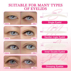 EMEDA application tools with tweezers and shaping liquid enable precise, easy placement.