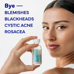 EMUAID overnight acne treatment blemish close-up showing spot-specific care