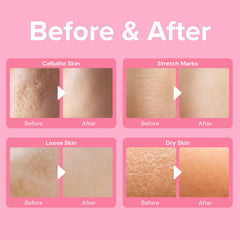 Enaskin Naturals 3D thermal tightening action suggesting instant lift on belly and thighs