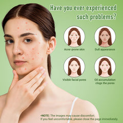 Eofot azelaic acid cream texture closeup showcases creamy consistency ideal for daily use.