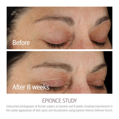 Epionce Intense Defense Serum vitamin chart highlights botanical vitamins for skin nutrition.