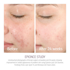 Epionce Purifying Toner spritz bottle offers quick cooling application to reduce shine.