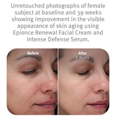 Epionce Renewal Facial Cream on cheek illustrates daily hydration for dry, sensitive skin