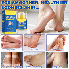 Eqimznv 60% Urea Stick hands application shows moisture on rough skin.