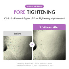 EQQUALBERRY Pore before-after shows elasticity improvement