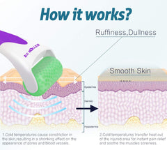 ESARORA Ice Roller pores-care image highlights pore tightening during routine care.